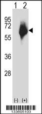 MMP2 Antibody