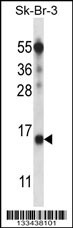BTF3L4 Antibody