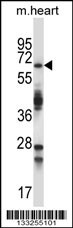 TRIM45 Antibody