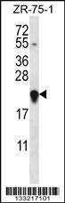 GAGE12H Antibody