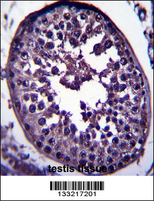 GAGE12H Antibody