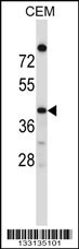 OR4C16 Antibody