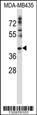 DNAJC28 Antibody