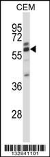 CORO2A Antibody