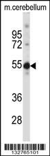 TSPYL5 Antibody