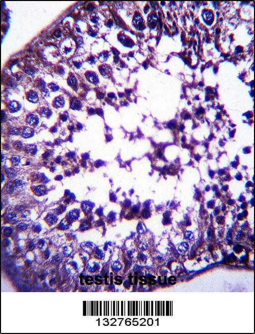 TSPYL5 Antibody