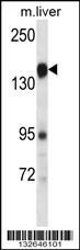 PLXNC1 Antibody