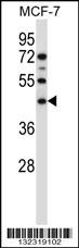 SGMS1 Antibody