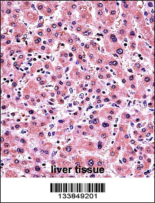 ALPP Antibody