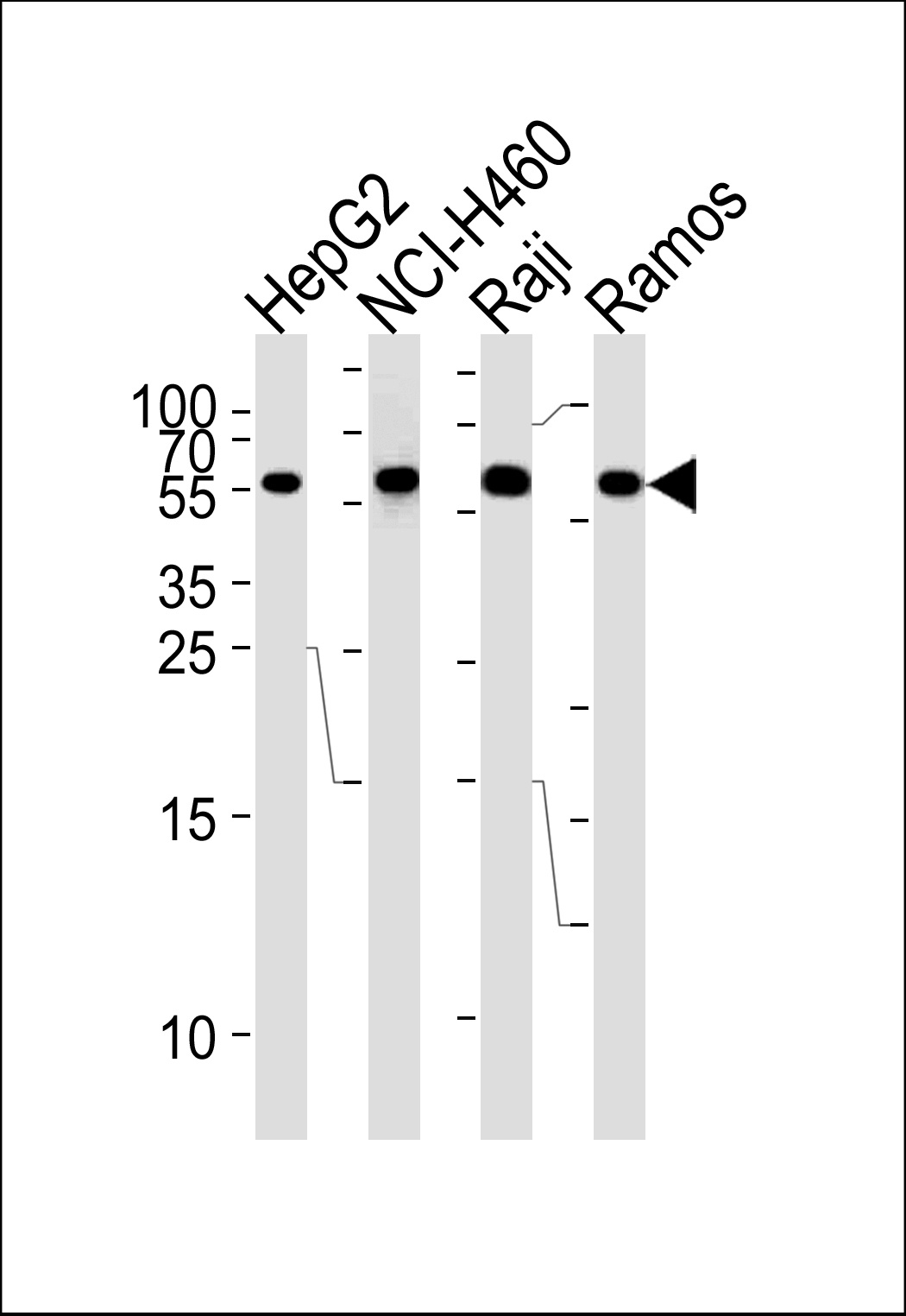 MMP3 Antibody