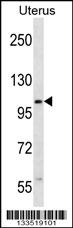 ZSWIM5 Antibody