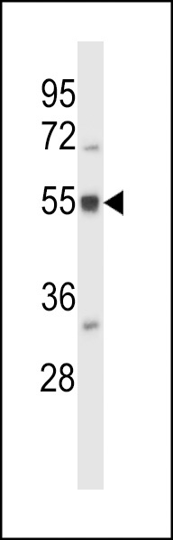 BAIAP2L2 Antibody