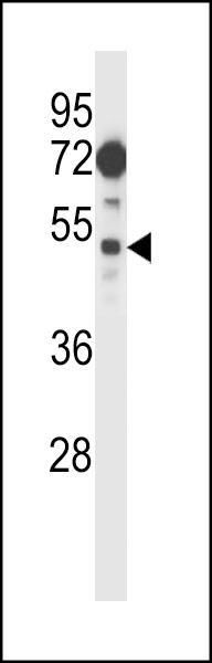 FIZ1 Antibody