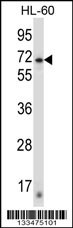 ZNF415 Antibody