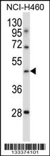 TLE6 Antibody