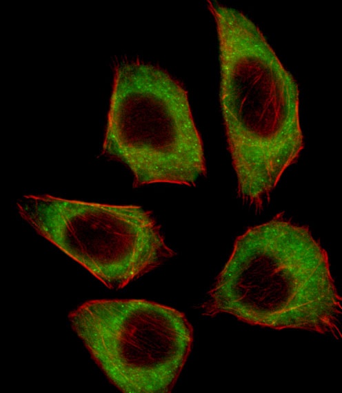 CSRNP2 Antibody