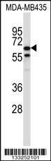 TRIM39 Antibody