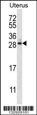 ARL8A Antibody