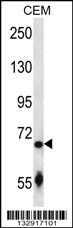 SLC27A3 Antibody