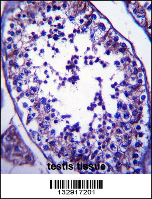 SLC27A3 Antibody