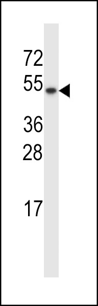 TXNDC15 Antibody