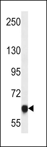 MAGED4B Antibody