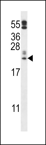 C10orf58 Antibody
