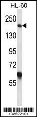 MYOM1 Antibody