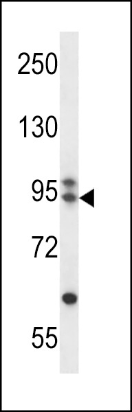 ARMC9 Antibody