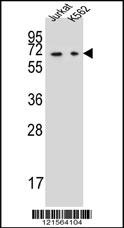 DPYS Antibody