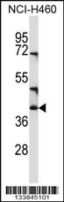CD1C Antibody