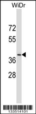 DUOXA2 Antibody