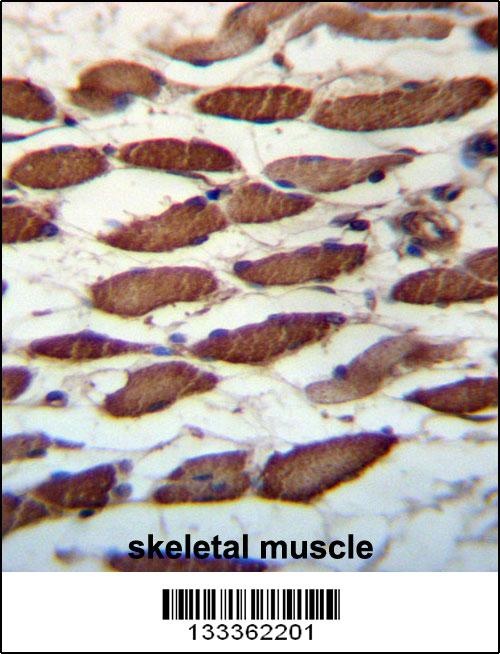 USP45 Antibody