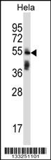 TRIM38 Antibody