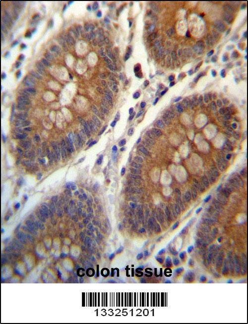 TRIM38 Antibody