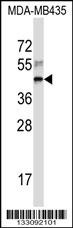 RPL3 Antibody