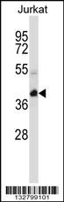 KCTD10 Antibody