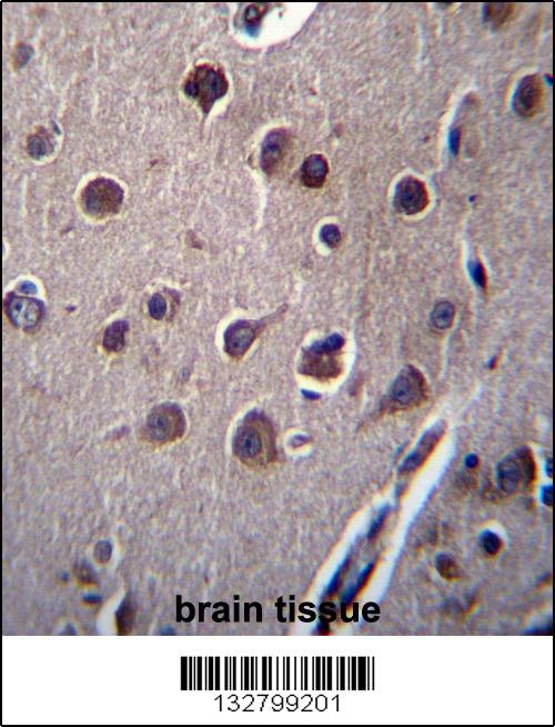KCTD10 Antibody