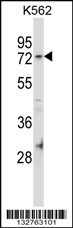 FAM63B Antibody