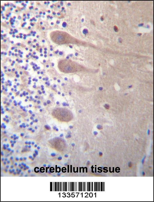 ZNF764 Antibody