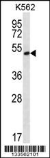 MORN1 Antibody
