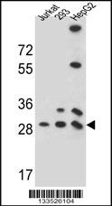 PGAM4 Antibody