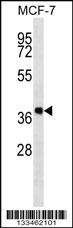 DHRS7B Antibody