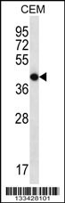 OR7G2 Antibody