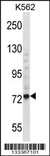THNSL1 Antibody