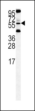 HTRA1 Antibody