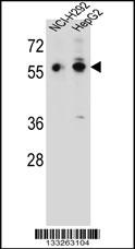 TRIM64 Antibody