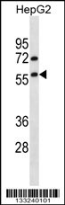 TRIM13 Antibody