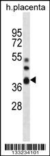 NT5C3L Antibody