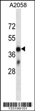 OR4D6 Antibody